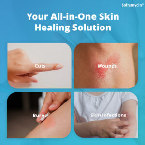 Soframycin Multi-Purpose Dusting Powder - Image 3